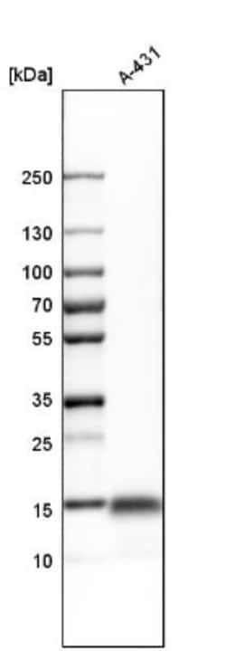 Ly-6D Antibody, Novus Biologicals 25 &mu;L; Unlabeled:Antibodies, Polyclonal