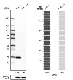 Ly-6D Antibody, Novus Biologicals 25 &mu;L; Unlabeled:Antibodies, Polyclonal