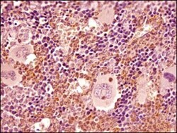 Ly-6G/Ly-6C Antibody (RB6-8C5) - BSA Free, Novus Biologicals 25&mu;g; Unlabeled:Antibodies,
