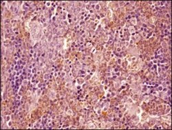 Ly-6G/Ly-6C Antibody (RB6-8C5) - BSA Free, Novus Biologicals 25&mu;g; Unlabeled:Antibodies,