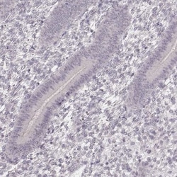Ly6K Antibody, Novus Biologicals:Antibodies:Primary Antibodies