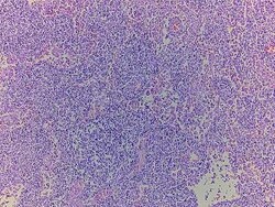 Novus Biologicals Lymph Node Tissue Slides (Adult Normal)- Paraffin 5 Slides | Buy Online | Novus Biologicals&trade; | Fisher Scientific