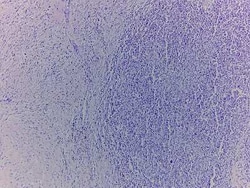 Novus Biologicals Lymph Node Tissue Slides (Non-hodgkin's lymphoma)- Paraffin 5 Slides | Buy Online | Novus Biologicals&trade; | Fisher Scientific