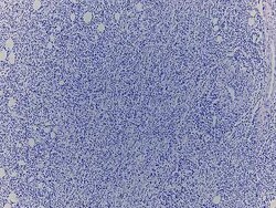 Novus Biologicals Lymph Node Tissue Slides (Non-hodgkin's lymphoma (T-Cell))- Paraffin 5 Slides | Buy Online | Novus Biologicals&trade; | Fisher Scientific