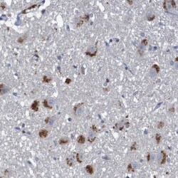 Lymphotoxin-alpha/TNF-beta Antibody, Novus Biologicals 25 &mu;L; Unlabeled:Antibodies,
