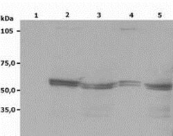 Lyn Antibody (LYN-01) - BSA Free, Novus Biologicals 0.1 mg | Buy Online | Novus Biologicals | Fisher Scientific