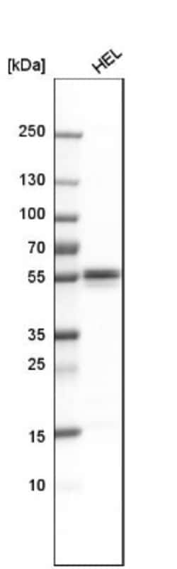 Lyn Antibody, Novus Biologicals 25 &mu;L; Unlabeled:Antibodies, Polyclonal