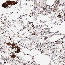 Lyp/PTPN22 Antibody, Novus Biologicals 0.1mL; Unlabeled:Antibodies, Polyclonal