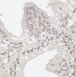Lysine (K)-specific Demethylase 5B/KDM5B/JARID1B Antibody, Novus Biologicals