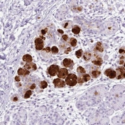 Lysozyme Antibody, Novus Biologicals 25 &mu;L, Unlabeled:Antibodies, Polyclonal