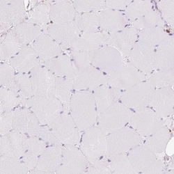 Lysozyme Antibody, Novus Biologicals 25 &mu;L, Unlabeled:Antibodies, Polyclonal