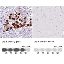 Lysozyme Antibody, Novus Biologicals 25 &mu;L, Unlabeled:Antibodies, Polyclonal