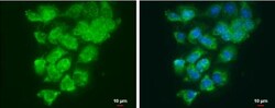 Lysyl Oxidase Homolog 2/LOXL2 Antibody, Novus Biologicals 0.1mg; Unlabeled:Antibodies,