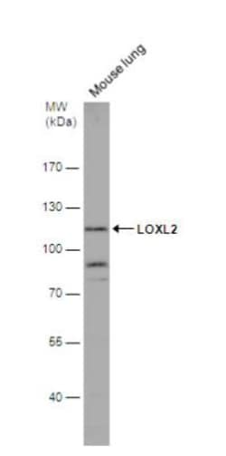 Lysyl Oxidase Homolog 2/LOXL2 Antibody, Novus Biologicals 0.1mg; Unlabeled:Antibodies,