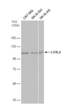 Lysyl Oxidase Homolog 2/LOXL2 Antibody, Novus Biologicals 0.1mg; Unlabeled:Antibodies,