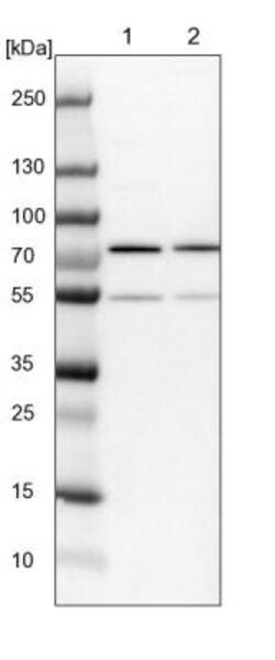 Lysyl tRNA synthetase Antibody, Novus Biologicals 0.1mL; Unlabeled:Antibodies,