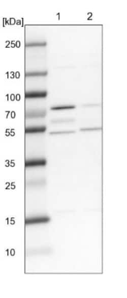 Lysyl tRNA synthetase Antibody, Novus Biologicals 0.1mL; Unlabeled:Antibodies,
