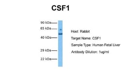 M-CSF Rabbit anti-Human, Mouse, Rat, Porcine, Canine, Guinea Pig, Polyclonal,