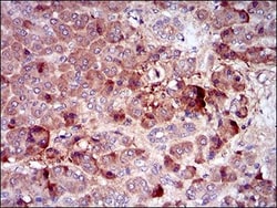 M-CSFR/CD115 Antibody (6B9B9) - BSA Free, Novus Biologicals 0.025 mL | Buy Online | Novus Biologicals | Fisher Scientific