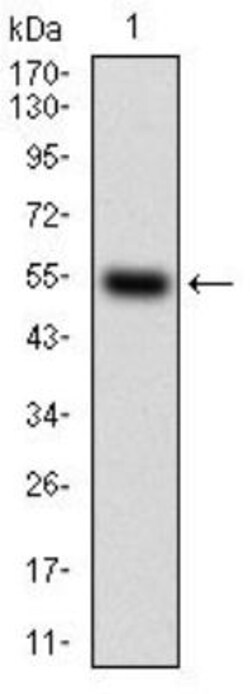 M-CSFR/CD115 Antibody (6B9B9) - BSA Free, Novus Biologicals 0.025 mL | Buy Online | Novus Biologicals | Fisher Scientific