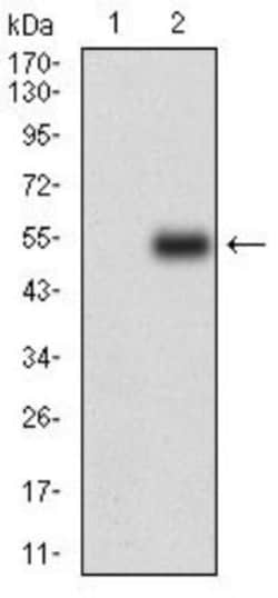 M-CSFR/CD115 Antibody (6B9B9) - BSA Free, Novus Biologicals 0.025 mL | Buy Online | Novus Biologicals | Fisher Scientific