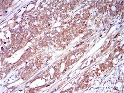 M-CSFR/CD115 Antibody (6B9H2) - BSA Free, Novus Biologicals 0.1mL; Unlabeled:Antibodies,