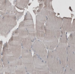 M-CSFR/CD115 Antibody, Novus Biologicals 0.1mL; Unlabeled:Antikörper