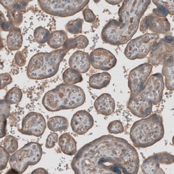 M-CSFR/CD115 Antibody, Novus Biologicals 0.1mL; Unlabeled:Antikörper
