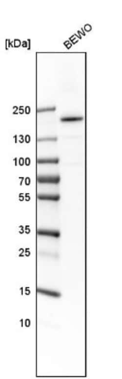 M-CSFR/CD115 Antibody, Novus Biologicals 0.1mL; Unlabeled:Antikörper