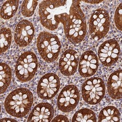 anti-M-Ras/R-Ras3, Polyclonal, Novus Biologicals 0.1mL; Unlabeled:Antibodies,