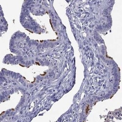 MAATS1 Rabbit anti-Human, Polyclonal, Novus Biologicals 100 &mu;g; Unconjugated:Antibodies,