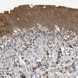 MACC1 Antibody, Novus Biologicals:Antibodies:Primary Antibodies
