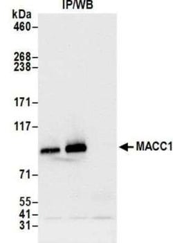 MACC1 Antibody (BLR135H), Novus Biologicals 100 &mu;g | Buy Online | Novus Biologicals | Fisher Scientific