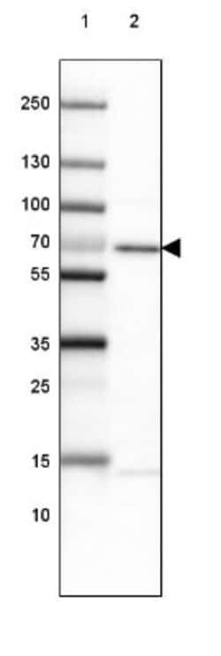MACC1 Antibody, Novus Biologicals:Antibodies:Primary Antibodies