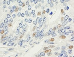 MAD1L1/MAD1 Antibody, Novus Biologicals 0.1mg; Unlabeled:Antibodies, Polyclonal