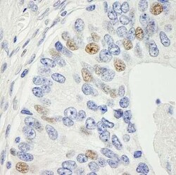 MAD1L1/MAD1 Antibody, Novus Biologicals 0.1mg; Unlabeled:Antibodies, Polyclonal