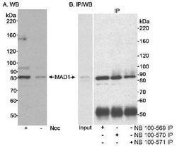 MAD1L1/MAD1 Antibody, Novus Biologicals 0.1mg; Unlabeled:Antibodies, Polyclonal
