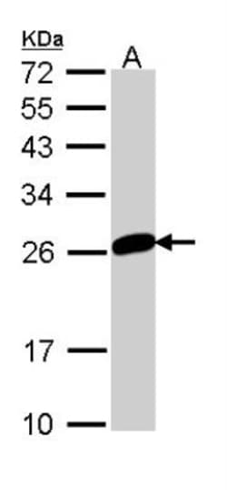 MAD2L1 Antibody, Novus Biologicals 0.1mg; Unlabeled:Antibodies, Polyclonal