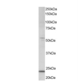 MAD4 Antibody, Novus Biologicals 0.1mg; Unlabeled:Antibodies, Polyclonal