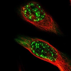 MAGEA4 Antibody, Novus Biologicals 0.1mL; Unlabeled:Antibodies, Polyclonal