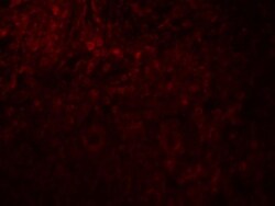 MAGEA4 Antibody - BSA Free, Novus Biologicals:Antibodies:Primary Antibodies