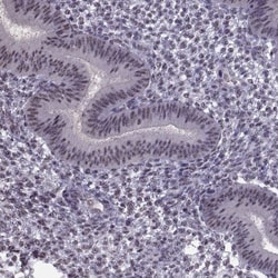 MAGEA4 Antibody, Novus Biologicals 0.1mL; Unlabeled:Antibodies, Polyclonal