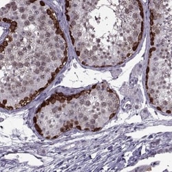 MAGEA4 Antibody, Novus Biologicals 0.1mL; Unlabeled:Antibodies, Polyclonal