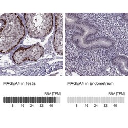 MAGEA4 Antibody, Novus Biologicals 0.1mL; Unlabeled:Antibodies, Polyclonal