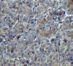 MAGEA4 Antibody - BSA Free, Novus Biologicals:Antibodies:Primary Antibodies