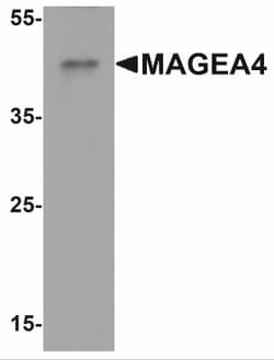 MAGEA4 Antibody - BSA Free, Novus Biologicals:Antibodies:Primary Antibodies