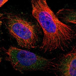 MAGEA8 Antibody, Novus Biologicals 0.1mL; Unlabeled:Antibodies, Polyclonal