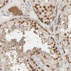 MAGEA8 Antibody, Novus Biologicals 0.1mL; Unlabeled:Antibodies, Polyclonal