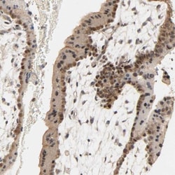 MAGEA8 Antibody, Novus Biologicals 0.1mL; Unlabeled:Antibodies, Polyclonal