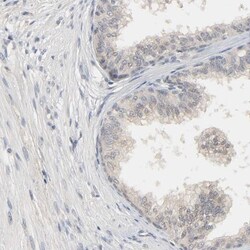 MAGEA8 Antibody, Novus Biologicals 0.1mL; Unlabeled:Antibodies, Polyclonal